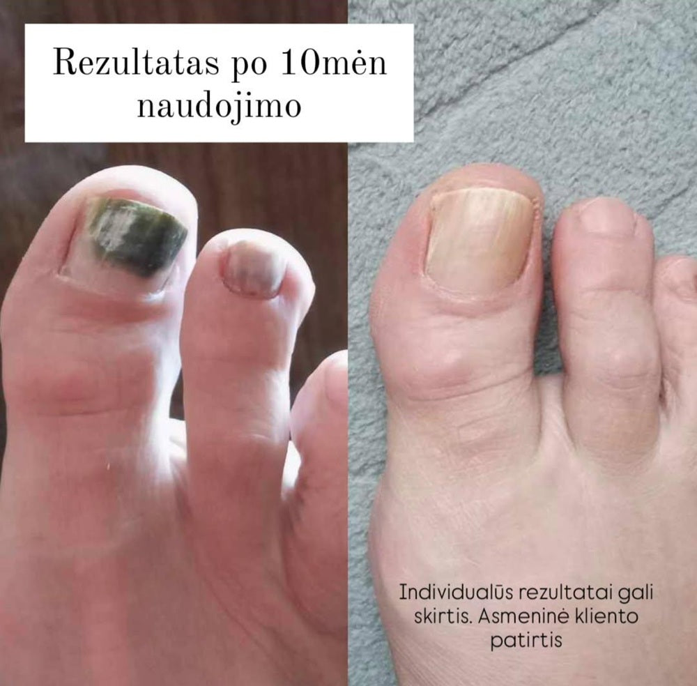 Clearance Active Nail Solution lašiukai