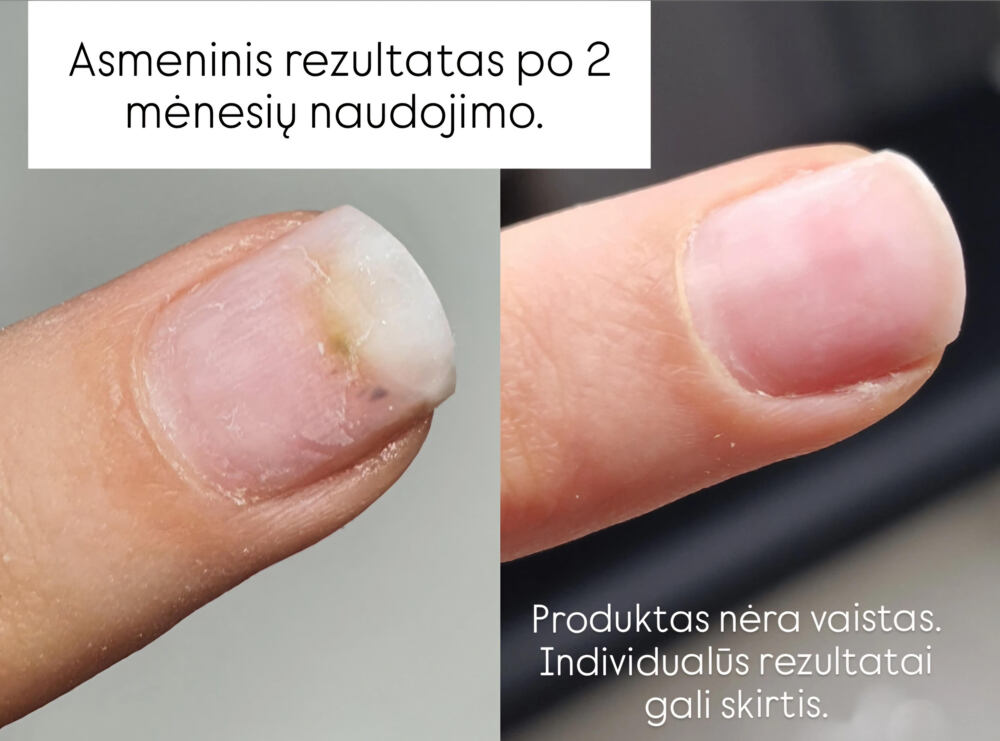 Clearance Active Nail Solution lašiukai